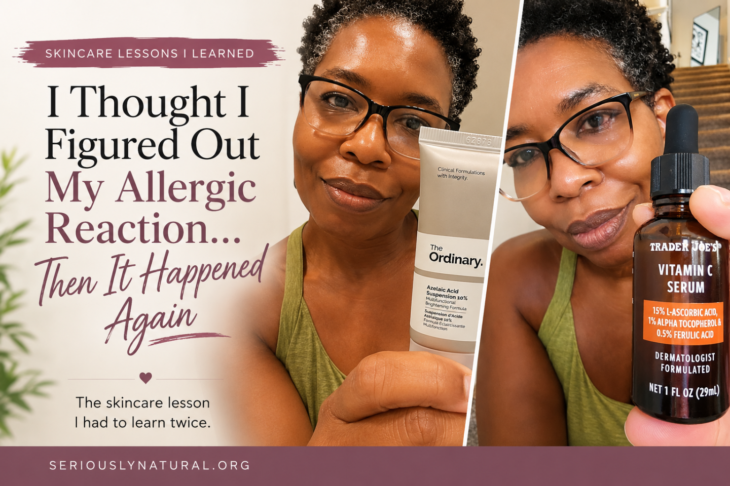 Sabrina with The Ordinary Azelaic Acid 10% and Trader Joe&rsquo;s Vitamin C Serum, two skincare products she used before experiencing skin reactions.